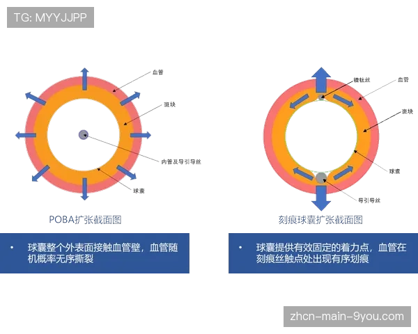 学术期刊发布研究:基于2025-26赛季意甲的定位球跑位模式AI分析 学术期刊发布研究:基于2025-26赛季意甲的定位球跑位模式AI分析